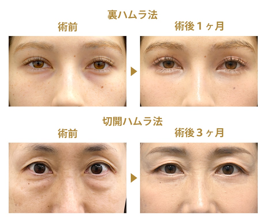ピックアップ症例写真
